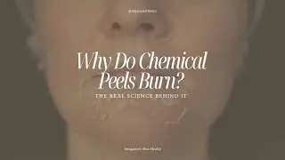 WHY DO CHEMICAL PEELS BURN?