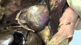 Cat's Heart