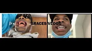 Come With Me To Get Braces During Quarantine | Braces Vlog !