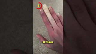 5 IMÁGENES INTERESANTES…