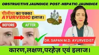 Obstructive/Post Hepatic Jaundice Causes, signs,Ayurvedic Treatment/पीलिया का इलाज