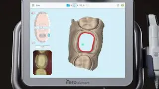 iTero® Scanner Tutorial: Using the Eraser Tool
