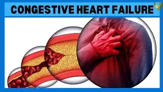 Advances and Insights in Congestive Heart Failure Management