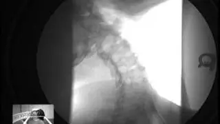 Motion Xray