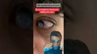 No te frotes más los ojos. 