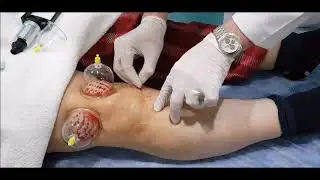 Doç. Dr. Kenan Şener uygulamalı anlattı...