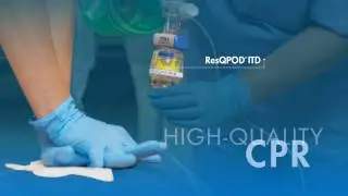 ZOLL CPR Technology