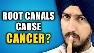 Do Root Canals Cause Cancer?