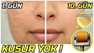 MUCİZE YAĞ! 10 GÜN BOYUNCA HER GECE YAP PORSELEN CİLT SENİN OLSUN │ Güzellik Bakım