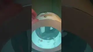 Порвалась медуза. Больно ли ей?
