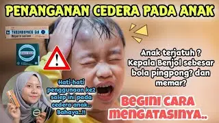 Cara Mengobati Luka Memar dan Benjol pada Anak di Rumah