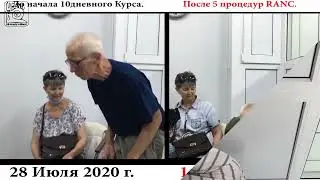 № 1014. Б.Паркинсона, последствия инсульта и Метод RANC.Отзывы о лечении в Клинике 