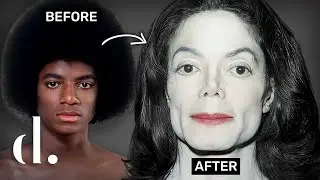 How Much Plastic Surgery Did Michael Jackson Actually Have?!! NEW DETAILS | the detail.