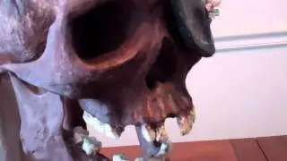 One Eyed Willie