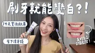 【實測藍光牙刷】🦷刷牙就能變白？｜無濾鏡對比真實結果｜省下萬元牙齒美白療程