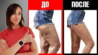 Лимфодренажная тренировка ног. Убираем отечность