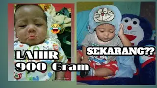 PERKEMBANGAN BAYI PREMATUR DARI 0 SAMPAI 14 BULAN (PHOTO STORY)