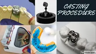 Casting Procedure