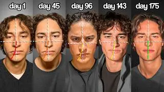 I Spent 175 Days Fixing My Asymmetry | 4-Step Guide