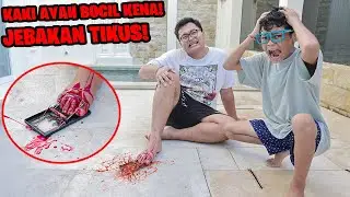 KASIHAN!!! KAKI AYAH BOCIL TERKENA JEBAKAN TIKUS SAMPAI BERDARAH!!!