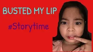 Story Time Of How I Busted My LIP!?!?😨