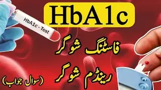 HBA1C Test | Fasting Blood Sugar | Random Blood Sugar tests Explained