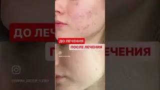 ДО и ПОСЛЕ лечения у доктора Юдиной М.М.