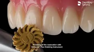 Enhance Flex from Dentsply Sirona