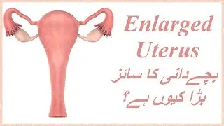 Englarged Uterus