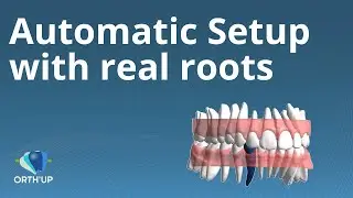 Automatic setup | ORTH'UP new interface