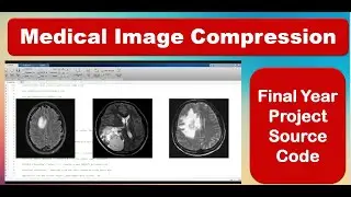Medical Image Compression Using Matlab | Medical Image Compression Using Image Processing