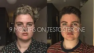 9 months on testosterone comparison // FTM transgender