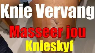 Totale knie vervanging 