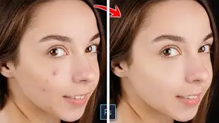 How To Remove Blemishes In Photoshop (3 Min) | Smooth Skin Without Losing Skin Texture