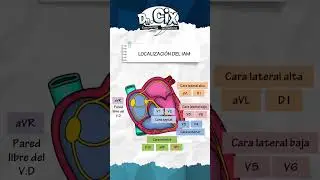 Localización del infarto agudo de miocardio en el ekg - Parte 1