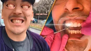 MI-AM PUS APARAT DENTAR