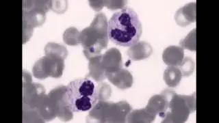 Virtual microscopy: Revolutionary means for EQAS in a near future