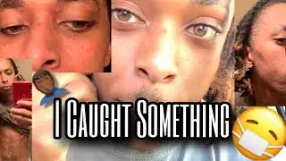 STORYTIME: I CAUGHT A STD !?!?