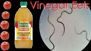 Vinegar Eels Under Microscope