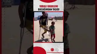 Filistinli bir çocuk, Gazze’deki saldırılardan kaçarken yaralı babası bacağından taşıdı