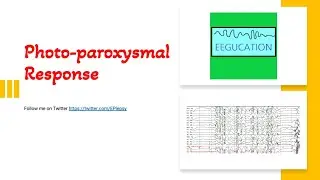 PhotoParoxysmal Response on the EEG