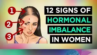 12 Signs Of HORMONAL IMBALANCE In WOMEN