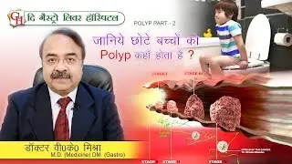 जानिये छोटे बच्चों को Polyp कहाँ होता है ? || Polyp part -2 || Dr.V.K.Mishra (M.D, DM (Gastro)