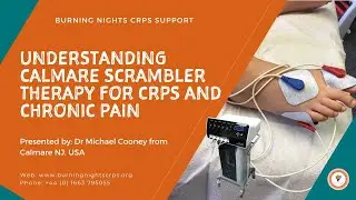 Understanding Calmare Scrambler Therapy for Complex Regional Pain Syndrome (CRPS)