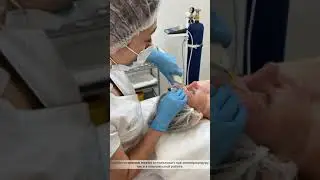 Карбокситерапия