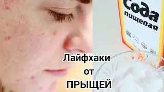 КАК ИЗБАВИТЬСЯ ОТ ПРЫЩЕЙ В ДОМАШНИХ УСЛОВИЯХ. 5 ДЕЙСТВЕННЫХ ЛАЙФХАКОВ для УЛУЧШЕНИЯ состояния КОЖИ
