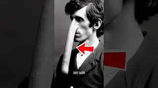 This Man Has The Longest Nose 😳 (thomas wadhouse)