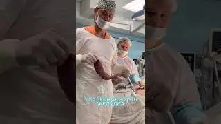 Бариатрическая операция для снижения веса