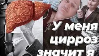 У МЕНЯ ЦИРРОЗ ПЕЧЕНИ. АЛКОГОЛЬ И НАРКОТИКИ 💉💊ПРЯМОЙ ПУТЬ К ЦИРРОЗУ ПЕЧЕНИ. 
