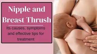 Nipple and breast thrush: Everything you need to know